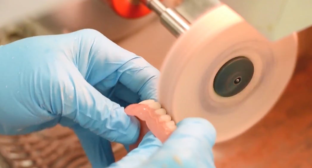 THE TEN STEPS TO DENTURE FABRICATION